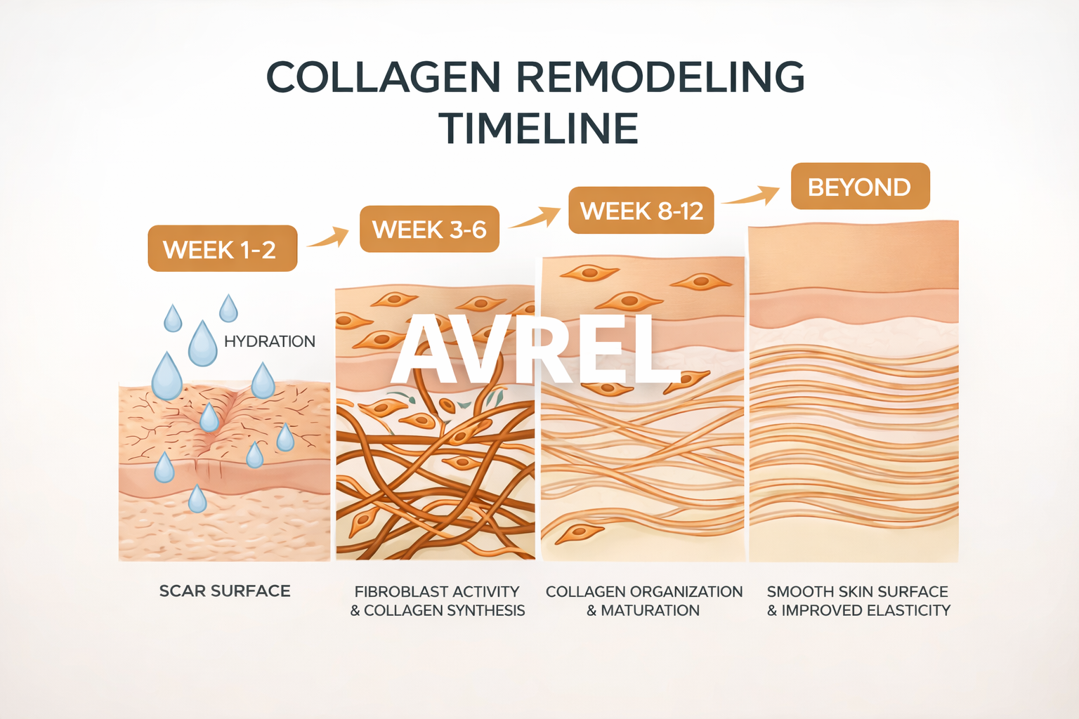 Avrel™ Scar Solutions Silicone Stick